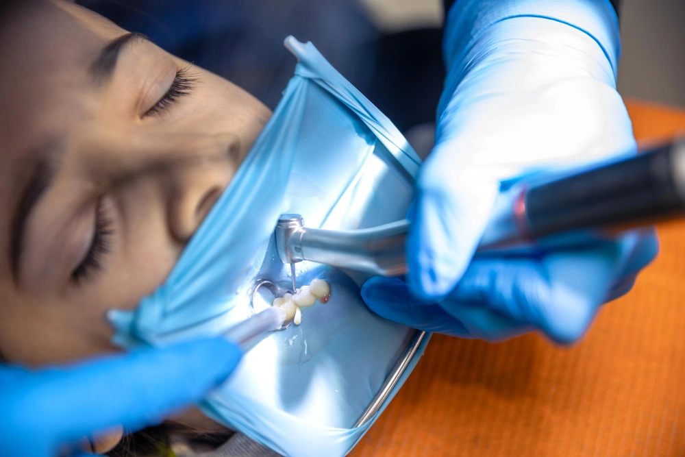 Root Canal Treatment