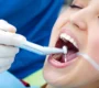 root canal blog page 90x80