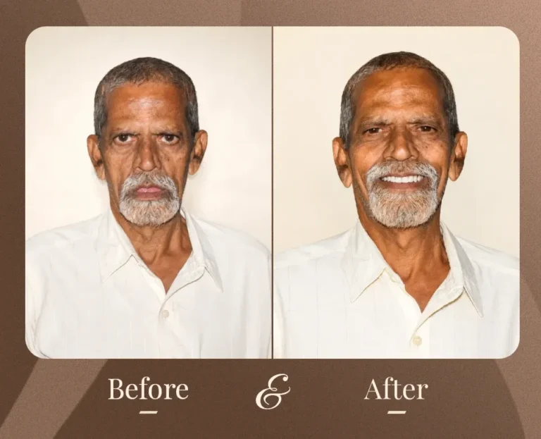 Smile Gallery