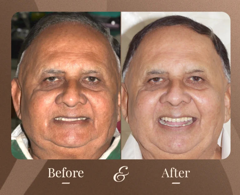 Smile Gallery