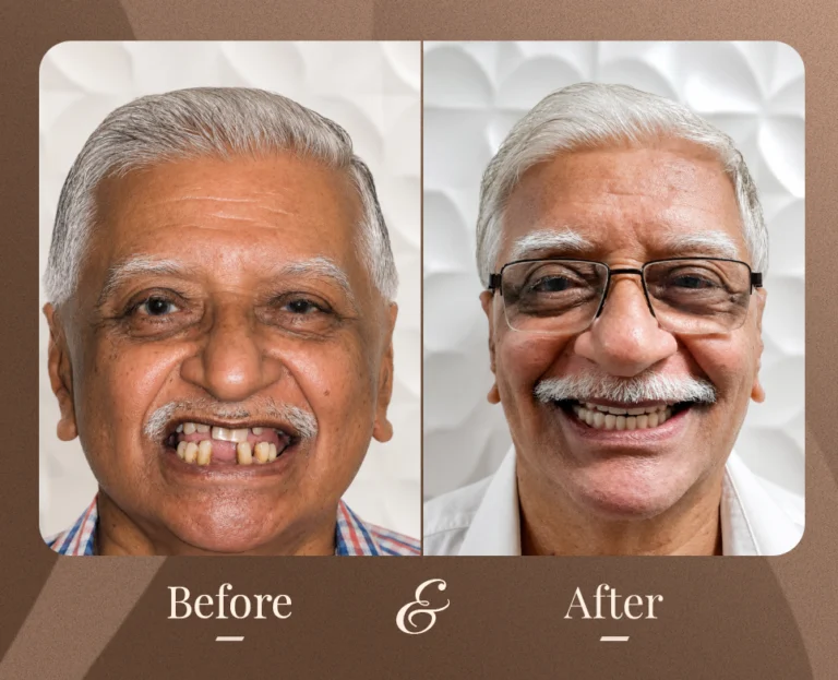 Smile Gallery