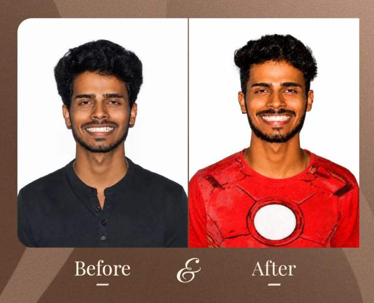 Smile Gallery
