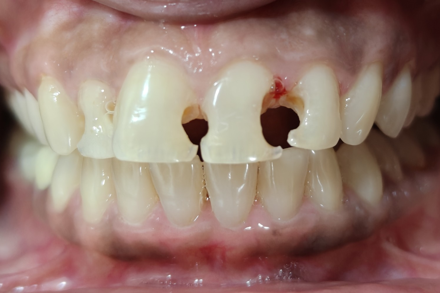 Smile Design before 7